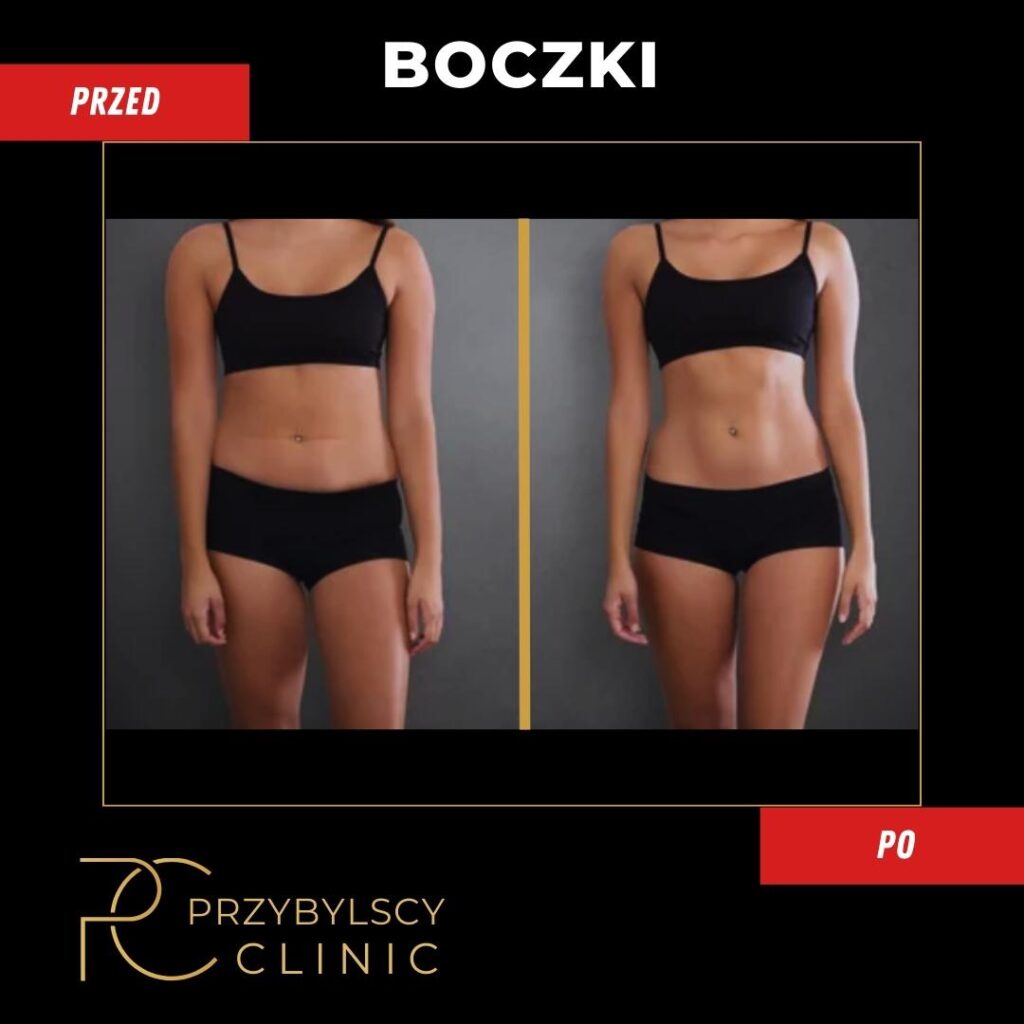 Boczki - modelowanie ciała