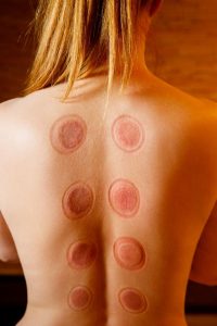 Masaż bańką chińską